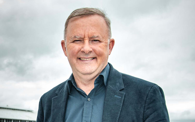 Citizen Murdoch and Albanese