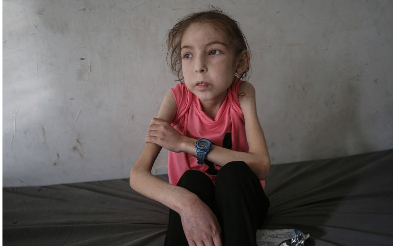 'This isn't me': Israeli war and healthcare collapse leave Gaza child unrecognisable