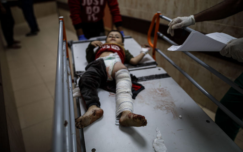 As you read this, physicians are amputating childrens’ hands, arms and legs without anaesthesia