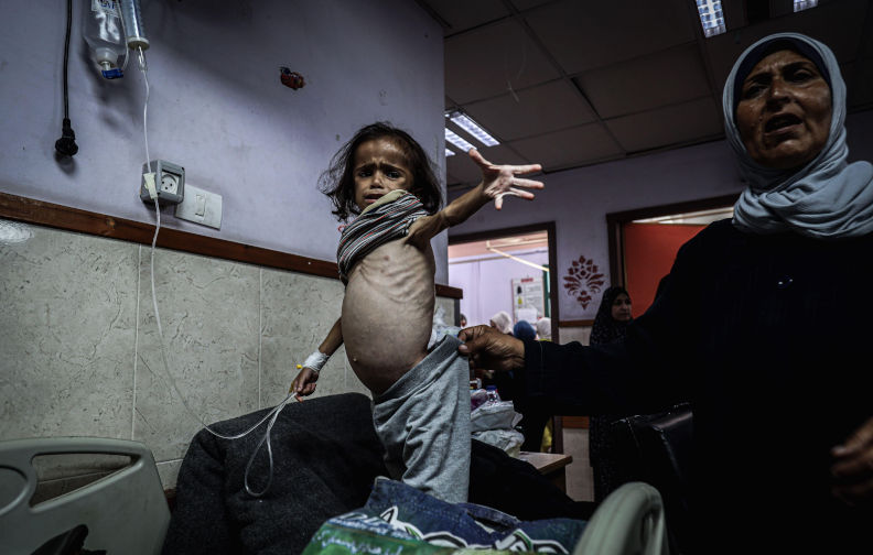 More than 5800 Gaza children diagnosed with malnutrition in June: UNICEF